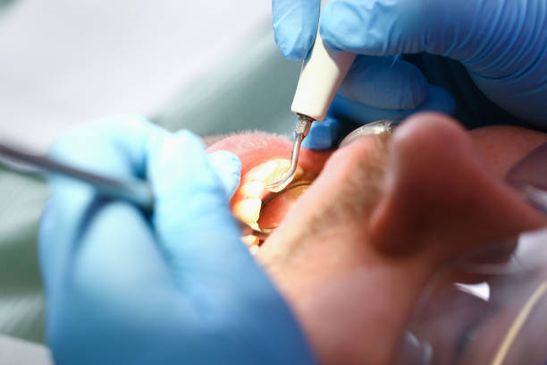 Best Weekend Emergency Dentist in Gilroy, CA