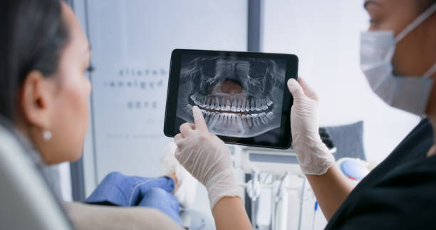 Best Emergency Treatment for Dental Infections or Abscesses in Gilroy, CA