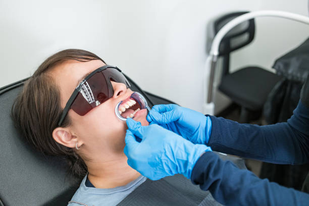Best Emergency Dental Care for Broken or Chipped Teeth in Gilroy, CA